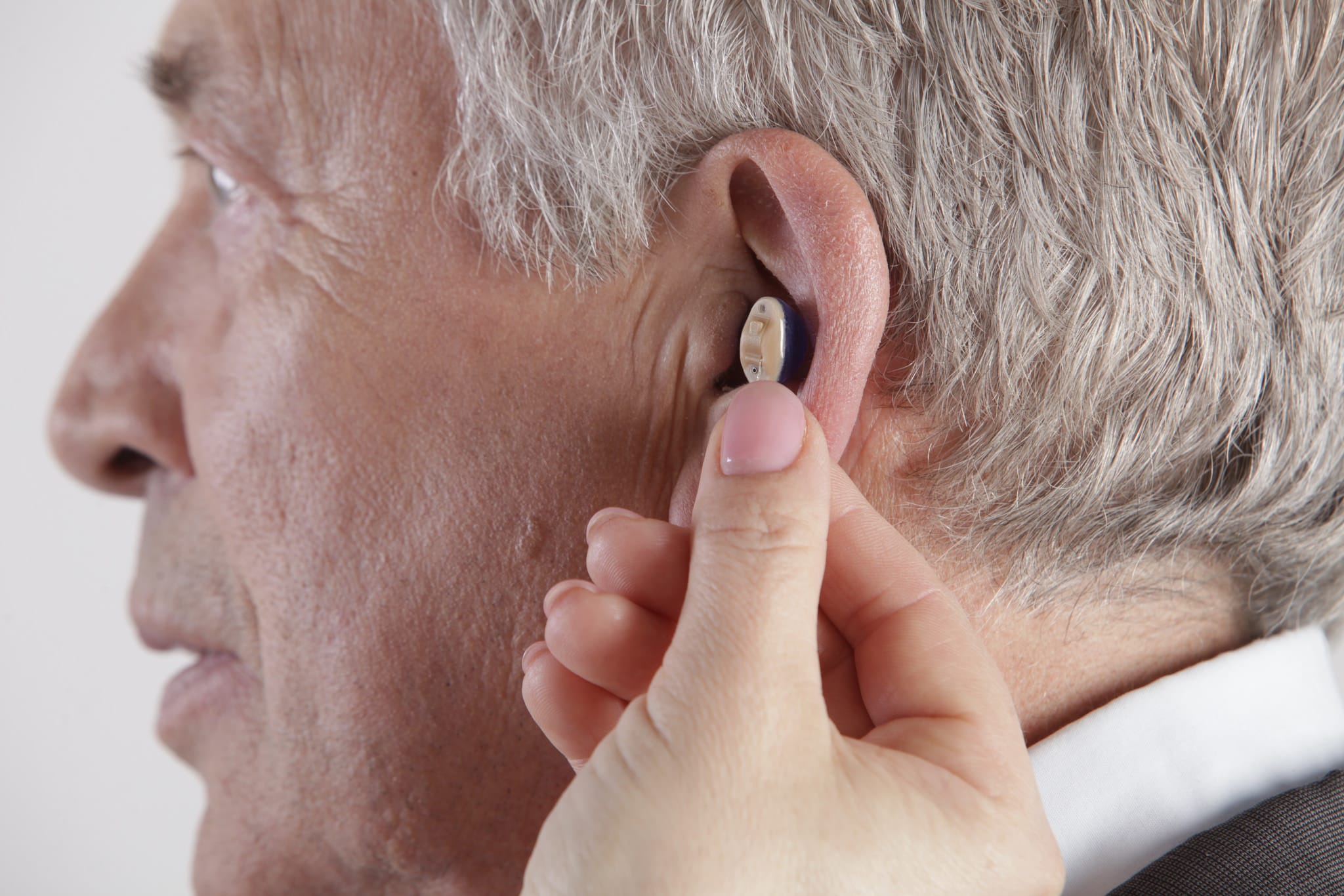 vergoeding hoortoestel