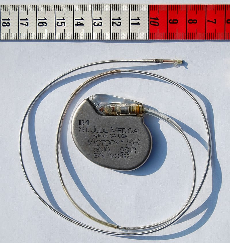 Pacemaker vergoeding