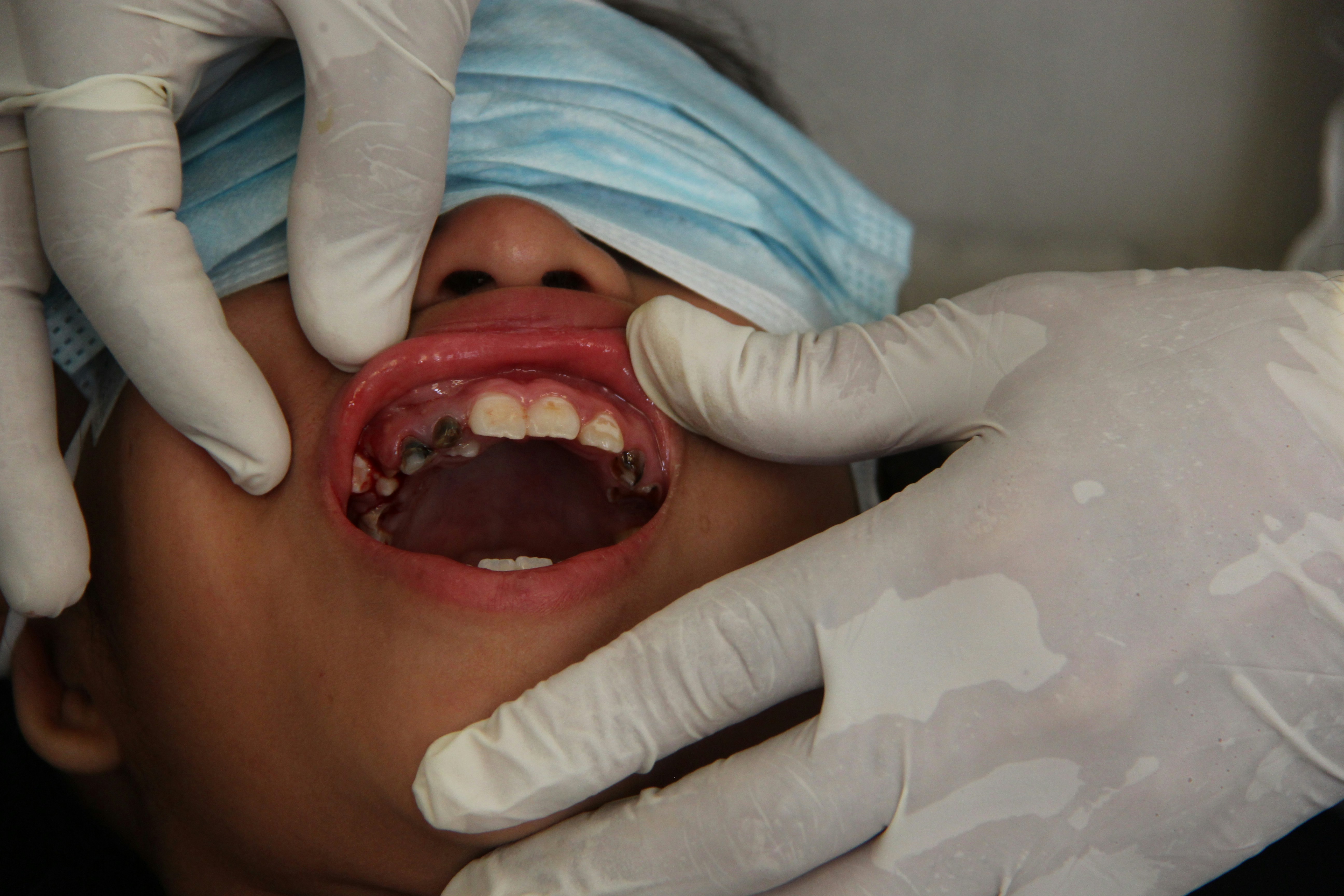 vergoeding parodontoloog